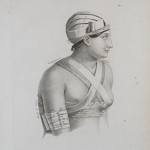 Bandage engraving from "Traité des Bandages" by Gerdy. Paris. 1837. Recent frame. Antique.